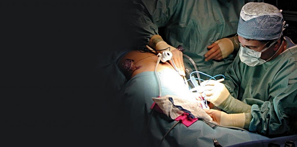 dr.mikemastrangelominimallyinvasiveherniasurgery Bend Hernia Center